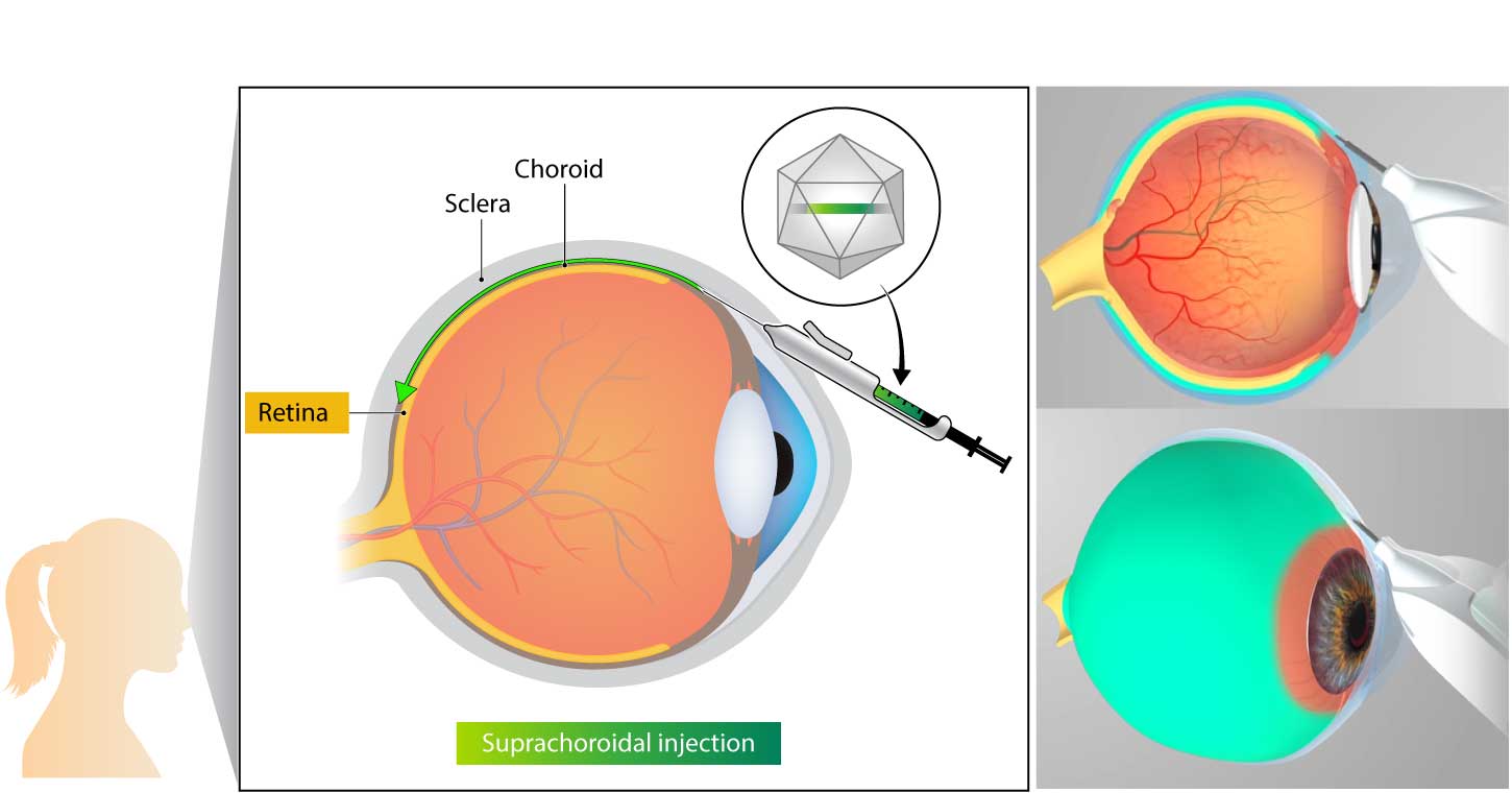ophthalmology-graphic-02